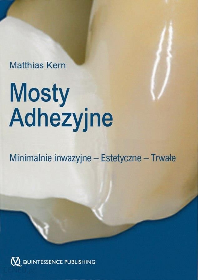 i-mosty-adhezyjne